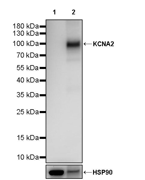 KCNA2 Recombinant Rabbit mAb (S-3939-53)