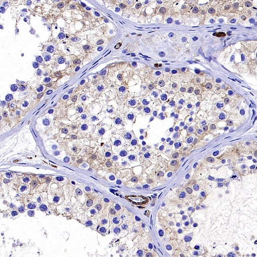 Transgelin 2 Recombinant Rabbit mAb (S-2809-73)