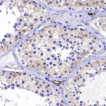 Transgelin 2 Recombinant Rabbit mAb (S-2809-73)