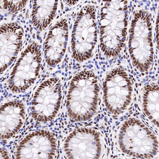 PRMT1 Recombinant Rabbit mAb (S-884-10)