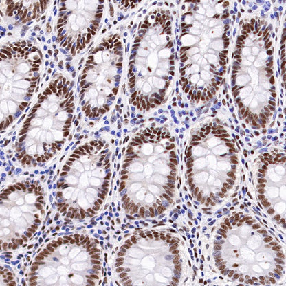 PRMT1 Recombinant Rabbit mAb (S-884-10)