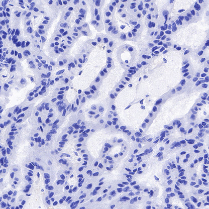 Galectin-3 Recombinant Rabbit mAb (SDT-370-111)
