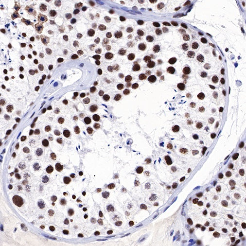 Dnmt1 Recombinant Rabbit mAb (S-R324)
