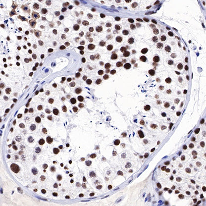 Dnmt1 Recombinant Rabbit mAb (S-R324)