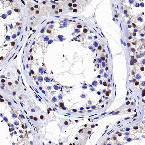 p27 Kip1 Recombinant Rabbit mAb (SDT-361-310)