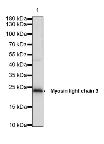 Myosin light chain 3 Recombinant Rabbit mAb (S-R277)