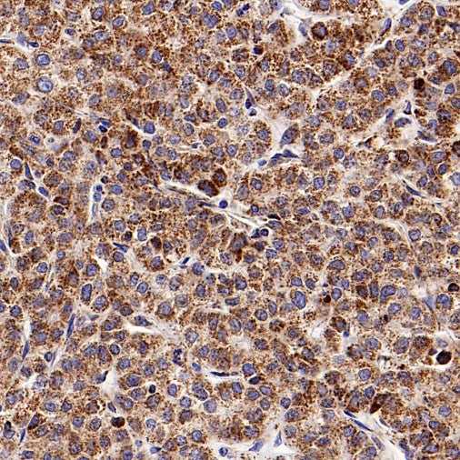 DLST Recombinant Rabbit mAb (S-2283-10)
