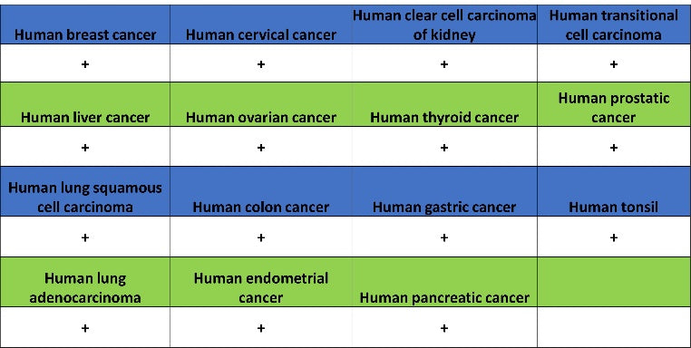 eEF2 Recombinant Rabbit mAb (S-1976-35)