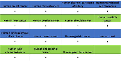 eEF2 Recombinant Rabbit mAb (S-1976-35)