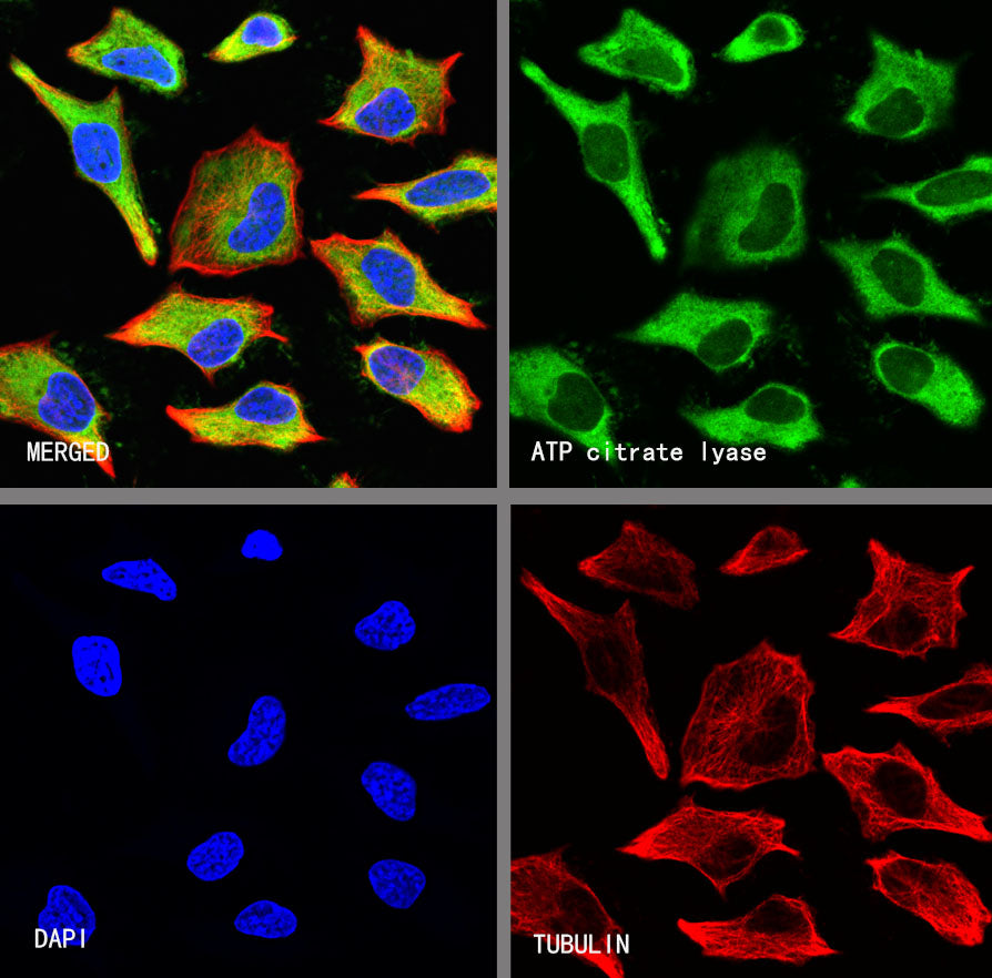 ATP Citrate Lyase Recombinant Rabbit mAb (S-5036)