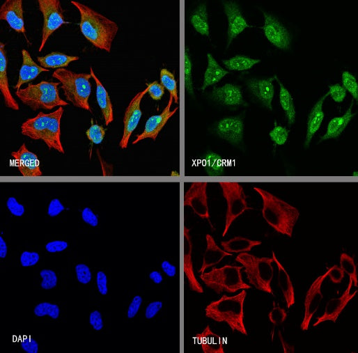 XPO1/CRM1 Recombinant Rabbit mAb (S-3309-7)