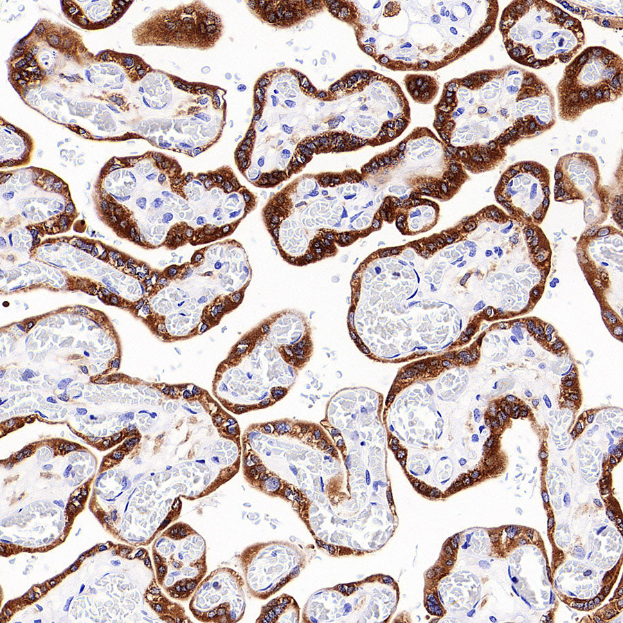 IMP3 Recombinant Rabbit mAb (S-6196)