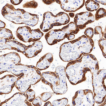 IMP3 Recombinant Rabbit mAb (S-6196)