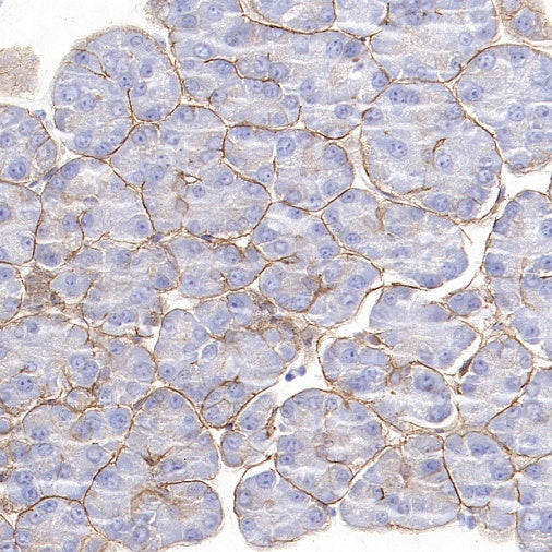 Integrin beta 4 Recombinant Rabbit mAb (S-1625-170)