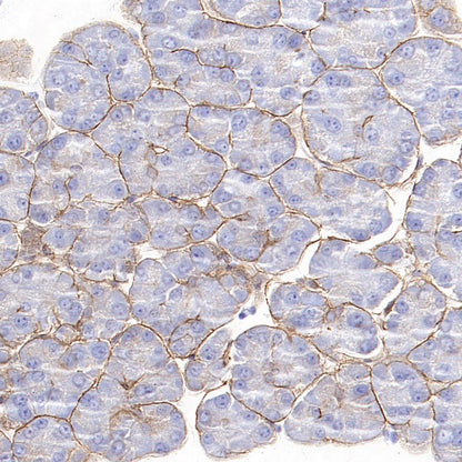Integrin beta 4 Recombinant Rabbit mAb (S-1625-170)