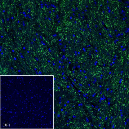 Caspr Recombinant Rabbit mAb (S-1706-1)