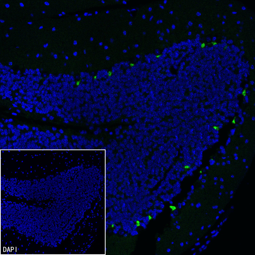 KCNA2 Recombinant Rabbit mAb (S-3939-53)