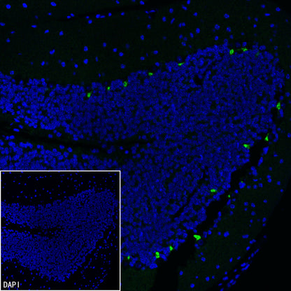 KCNA2 Recombinant Rabbit mAb (S-3939-53)