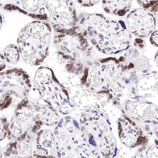 RanBP2 Recombinant Rabbit mAb (S-2593-310)