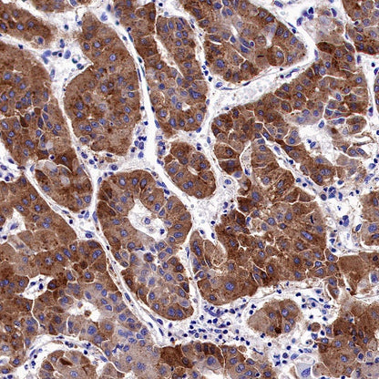 FGL1 Recombinant Rabbit mAb (S-1409-109)