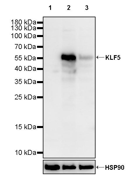 KLF5 Recombinant Rabbit mAb (S-3200-113)