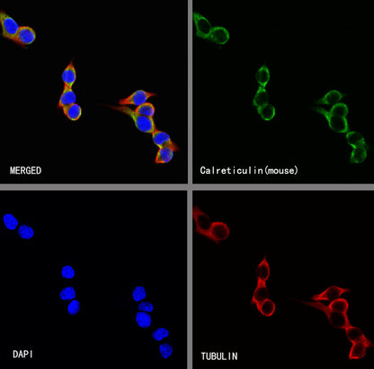 Calreticulin Recombinant Rabbit mAb (S-3920-39)