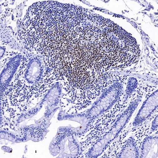 S-RMab® PAX5 Recombinant Rabbit mAb (SDT-R202)
