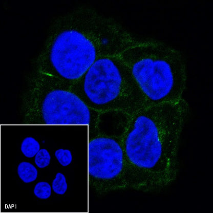 E-Cadherin Recombinant Rabbit mAb (FITC Conjugate) (S-438-5)