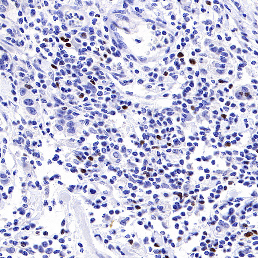 S-RMab® FOXP3 Recombinant Mouse mAb,PBS Only (SDT-R149)