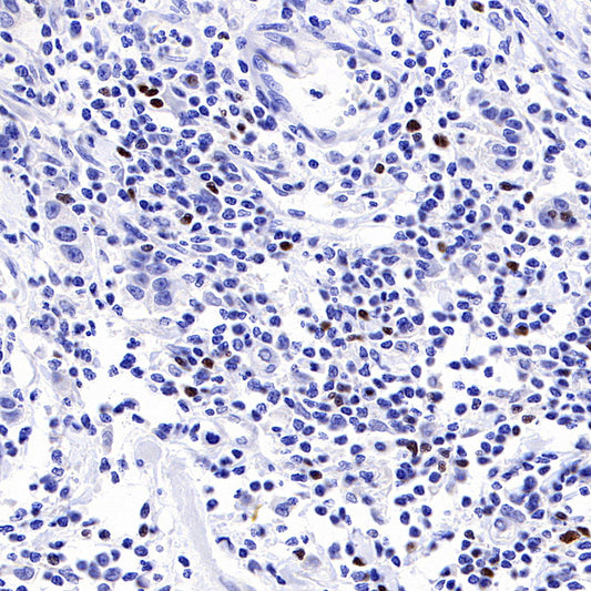 S-RMab® FOXP3 Recombinant Mouse mAb,PBS Only (SDT-R149)
