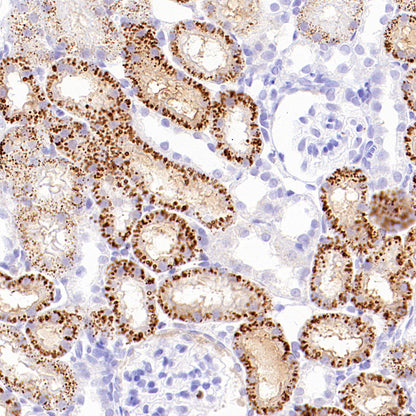 Napsin A Recombinant Mouse mAb (SDT-4204)