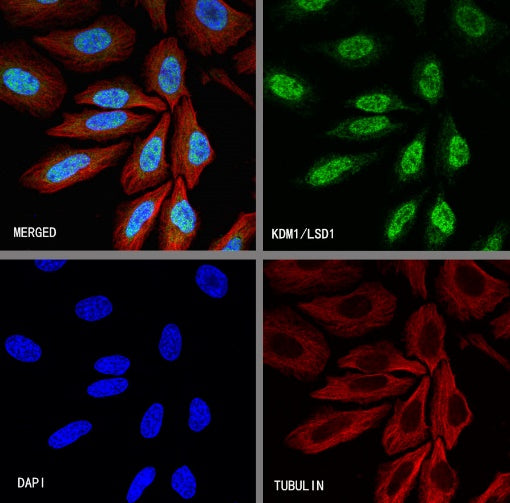 KDM1/LSD1 Recombinant Rabbit mAb (S-1280-80)