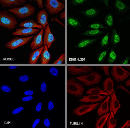 KDM1/LSD1 Recombinant Rabbit mAb (S-1280-80)