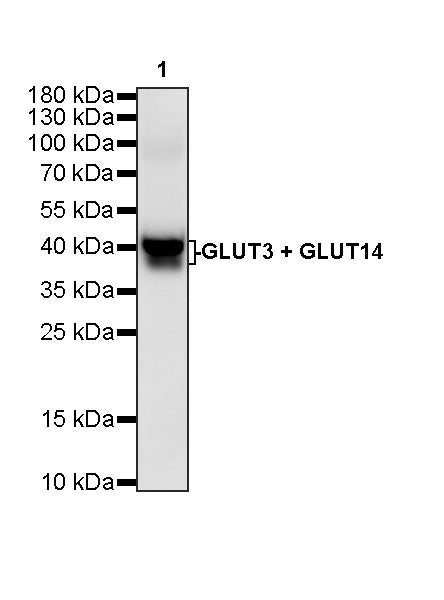 GLUT3 + GLUT14 Recombinant Rabbit mAb (S-5945)