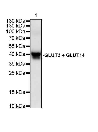 GLUT3 + GLUT14 Recombinant Rabbit mAb (S-5945)