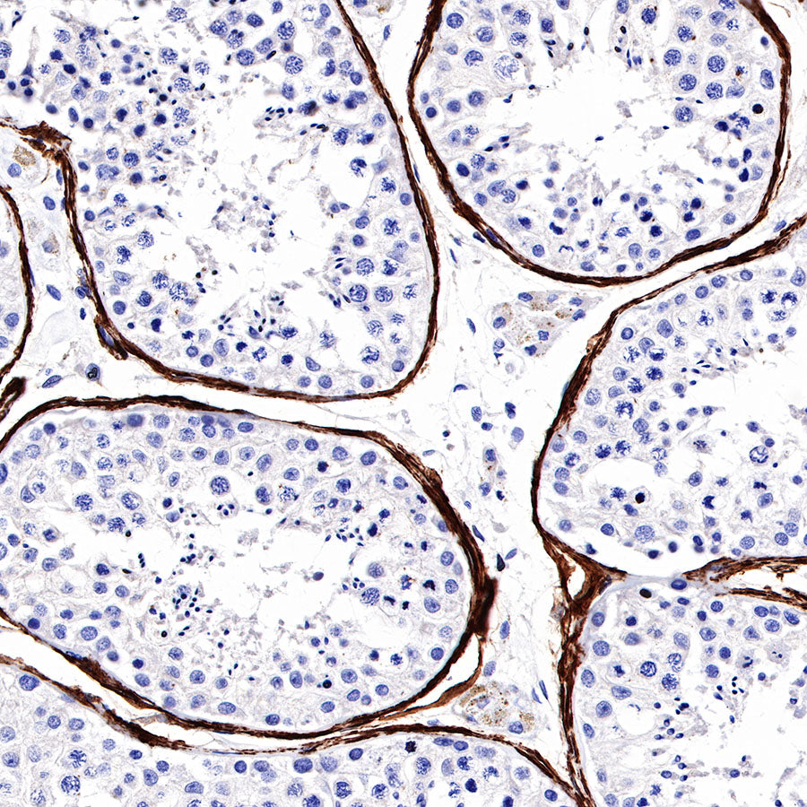 S-RMab® alpha smooth muscle Actin (SMA) Recombinant Rabbit mAb,PBS Only (SDT-301-142)