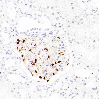 p57 Kip2 Recombinant Rabbit mAb (S-6119)
