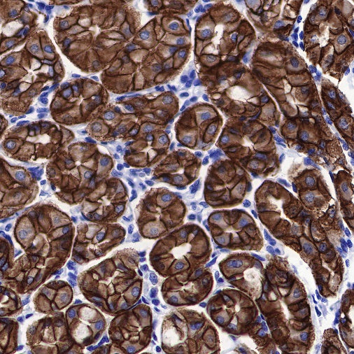 p120 Catenin Recombinant Rabbit mAb (SDT-350-75)