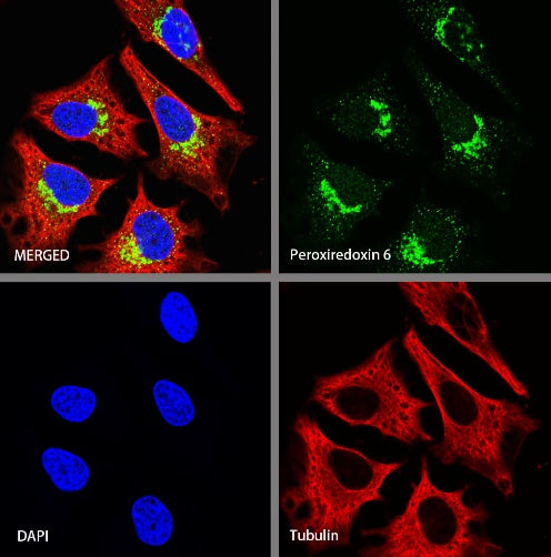 Peroxiredoxin 6 Rabbit Polyclonal Antibody