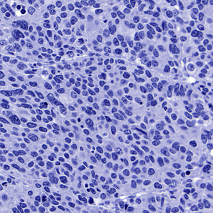 ITPR1 Recombinant Rabbit mAb (S-4530-5)
