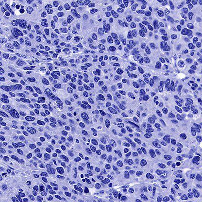 ITPR1 Recombinant Rabbit mAb (S-4530-5)
