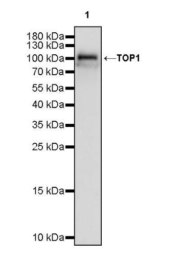 Topoisomerase I/TOP1 Recombinant Rabbit mAb (S-822-60)