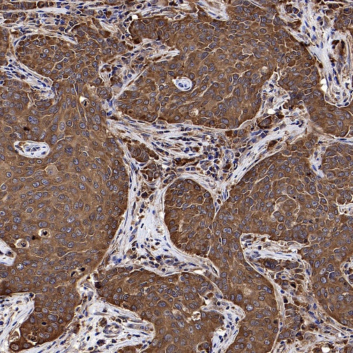CAD/BM1 Recombinant Rabbit mAb (S-1650-72)