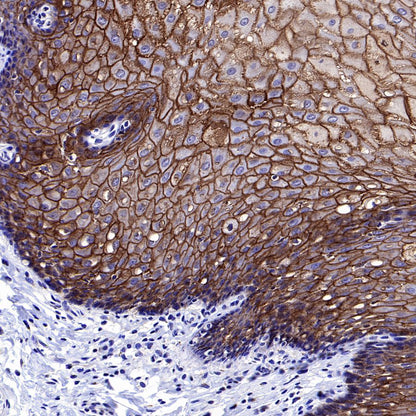 Desmocollin-2/3(DSC2/3) Recombinant Rabbit mAb (SDT-2102-59)