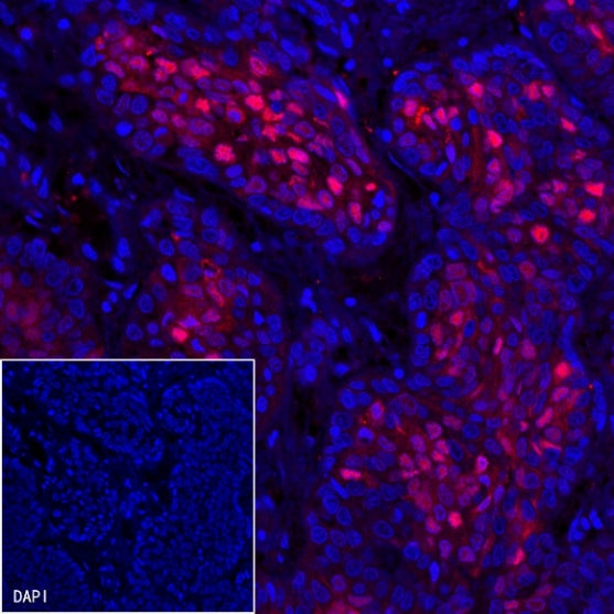 p21 Waf1/Cip1 Recombinant Rabbit mAb (SDT-1349-71)