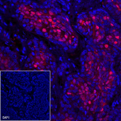 p21 Waf1/Cip1 Recombinant Rabbit mAb (SDT-1349-71)