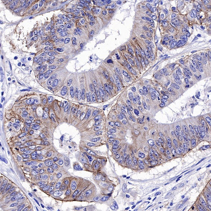 CD49f Recombinant Rabbit mAb (S-1019-73)