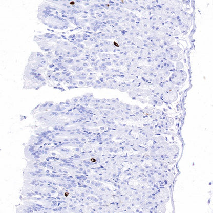 DCAMKL1 Recombinant Rabbit mAb (S-1705-76)