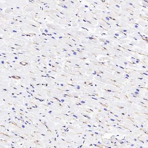 VE Cadherin Recombinant Rabbit mAb (S-3312-118)