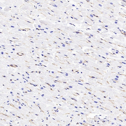 VE Cadherin Recombinant Rabbit mAb (S-3312-118)